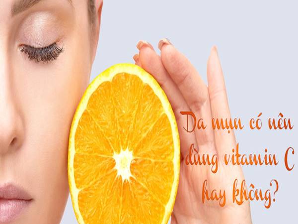 Da mụn có nên dùng Vitamin C? Những lưu ý khi dùng Vitamin C