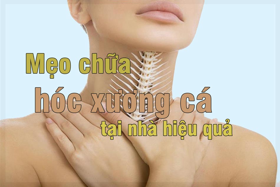 Mẹo hóc xương cá tại nhà đơn giản dễ dàng