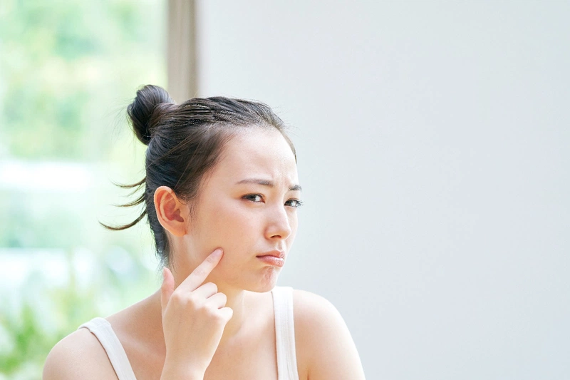 Vì sao vào mùa đông da hay bị khô căng?