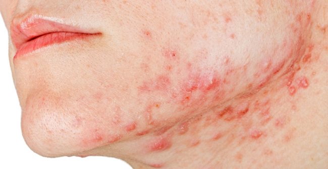 Thay đổi lối sống